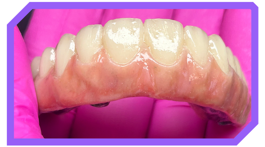 Protocolo Digital c/ Barra